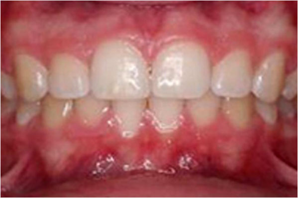 Orthodontics After